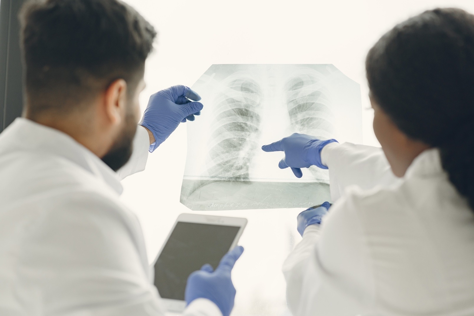 HUAP em foco: Inteligência artificial e ciência de dados ajudam no diagnóstico de doenças pulmonares